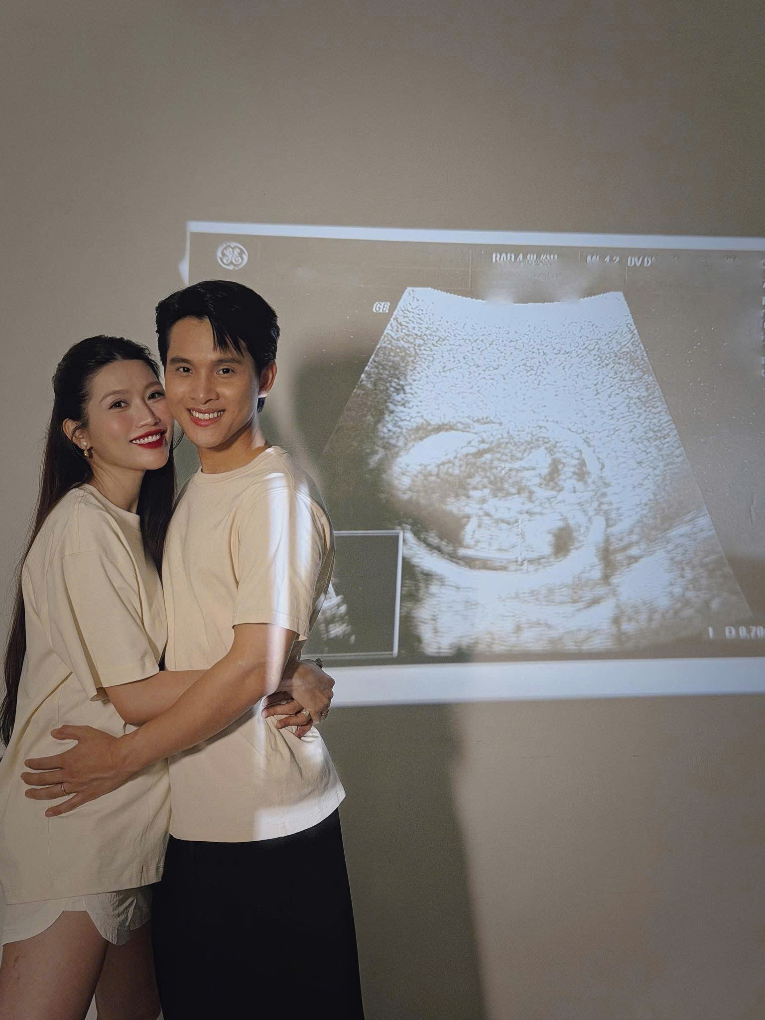 Á hậu Quỳnh Châu